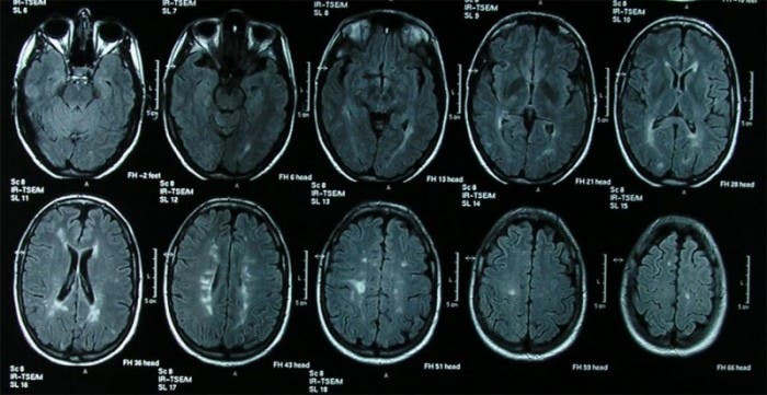 Imagen médica del cerebro humano