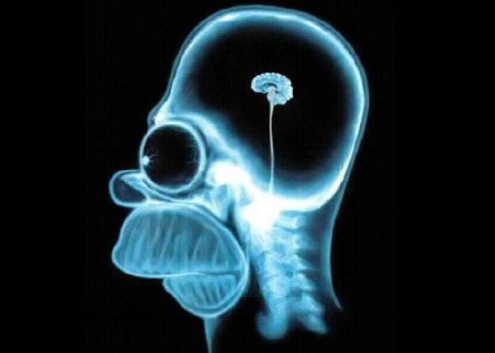 Cerebro Homer