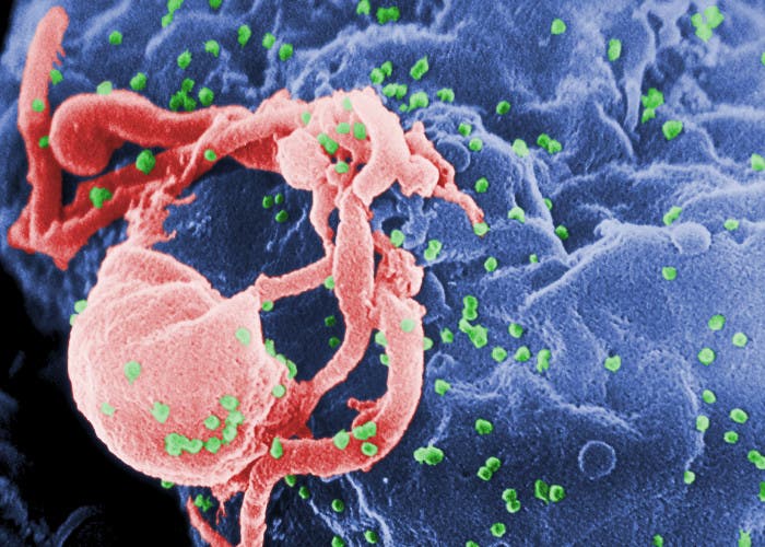 Virus del SIDA/VIH