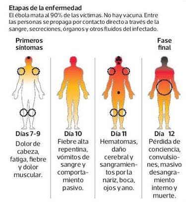 sintomas-ébola